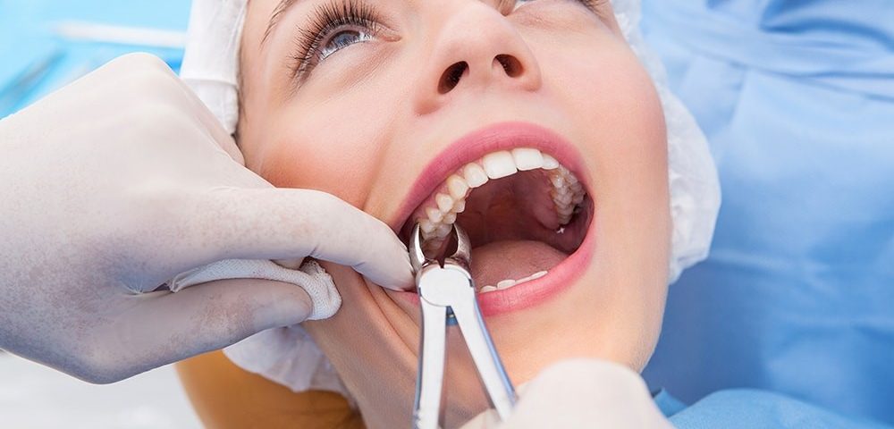 Tooth Romoval extraction oral surgeon dentist painfree dental treatment surgery in ahmedabad teeth care centre
