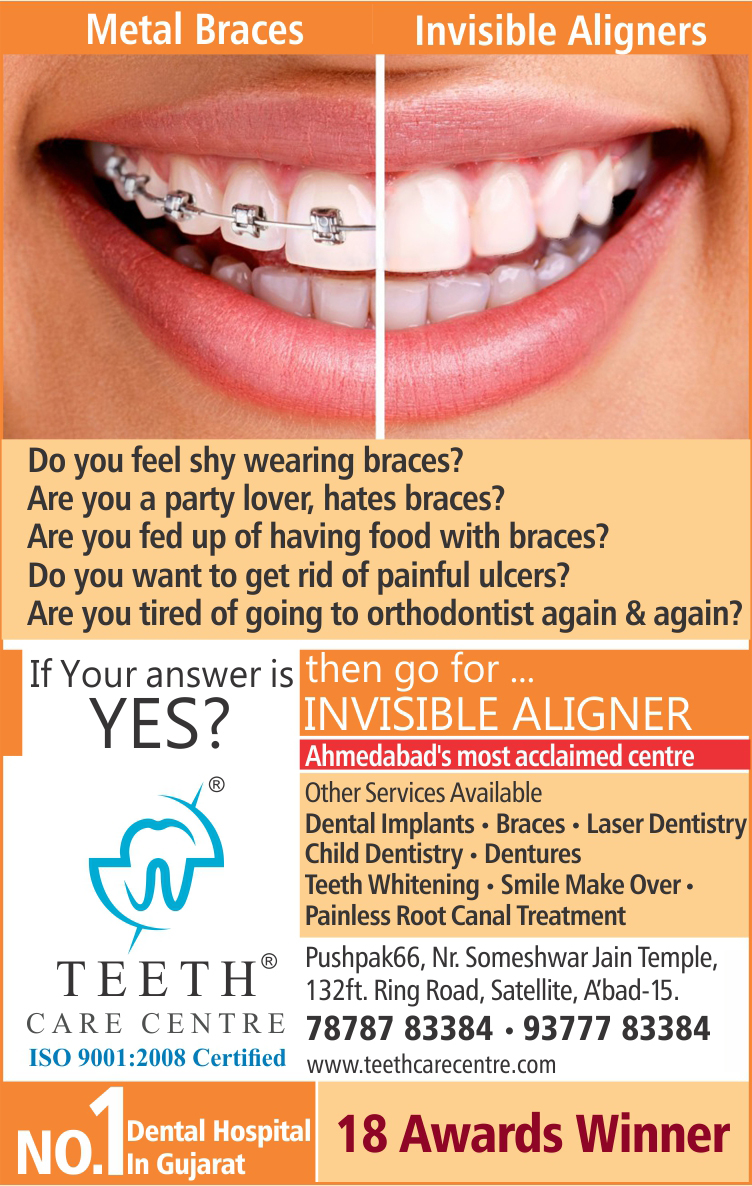 Invisible Clear Aligner Braces in Ahmedabad﻿ Teeth Care Centre